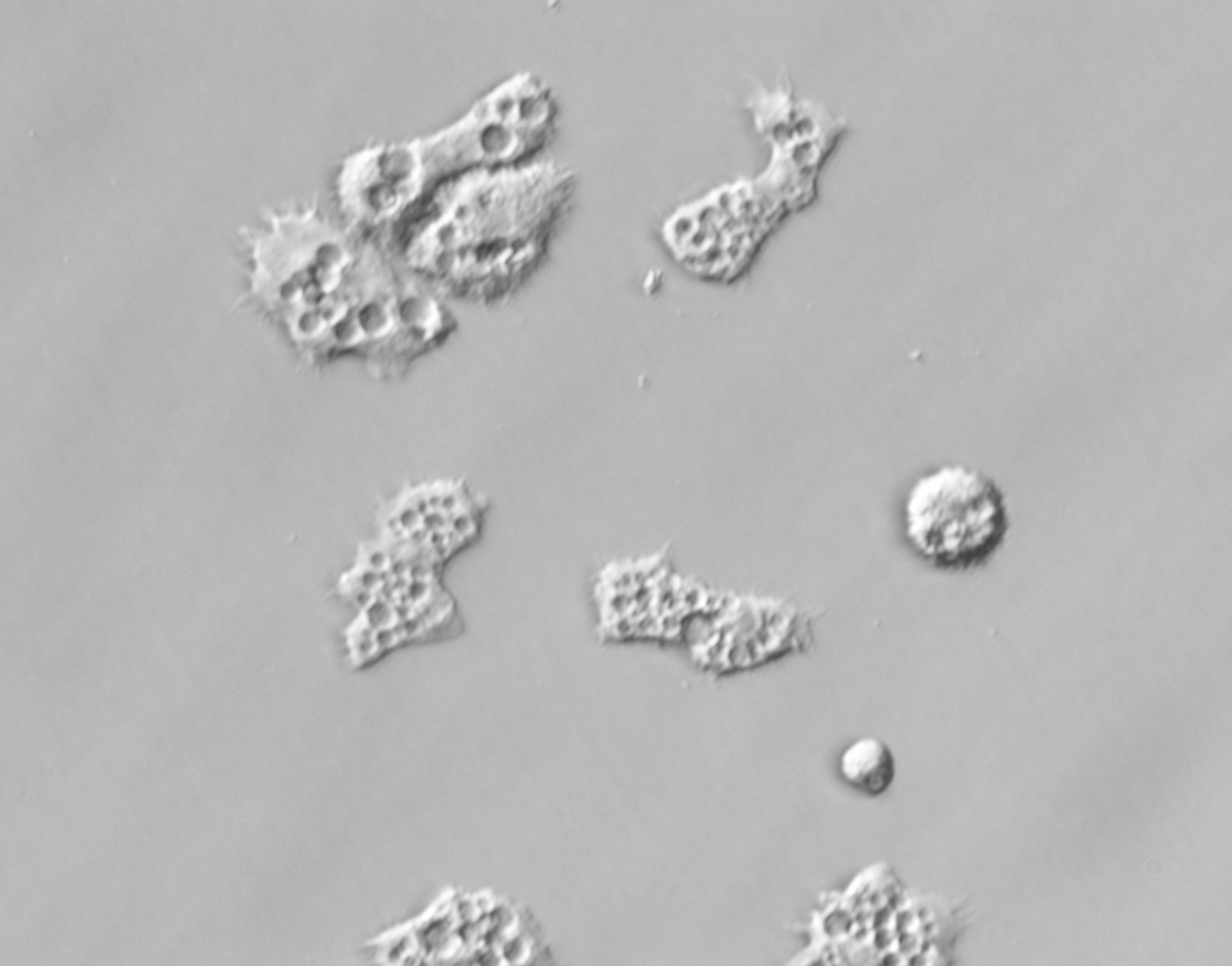 amibe Acanthamoeba castellanii 