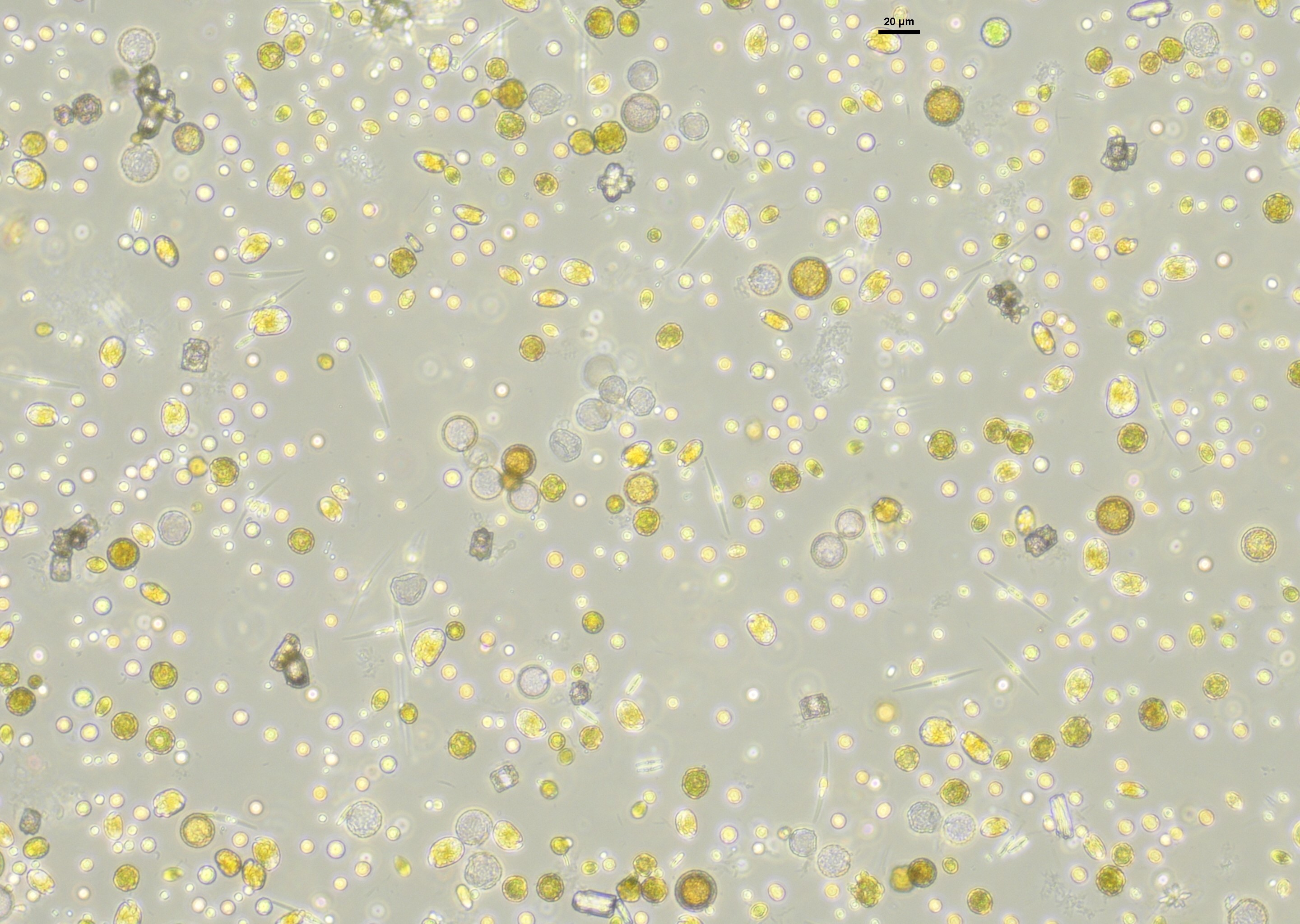 Vue microscopique d’une communauté de phytoplancton marin. Crédits : Elvire Bestion