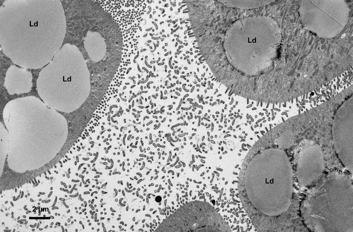 Bactéries Hepatincola dans la lumière des glandes digestives du cloporte Porcellionides pruinosus, espèce cosmopolite fréquemment rencontrée dans les composts (crédit photo M. Raimond UMR CNRS 7267).