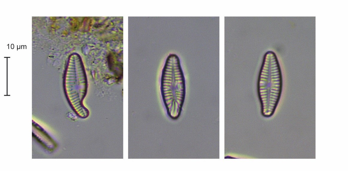 : observations au microscope optique de valves tératologiques de l’espèce Planothidium frequentissimum. 
