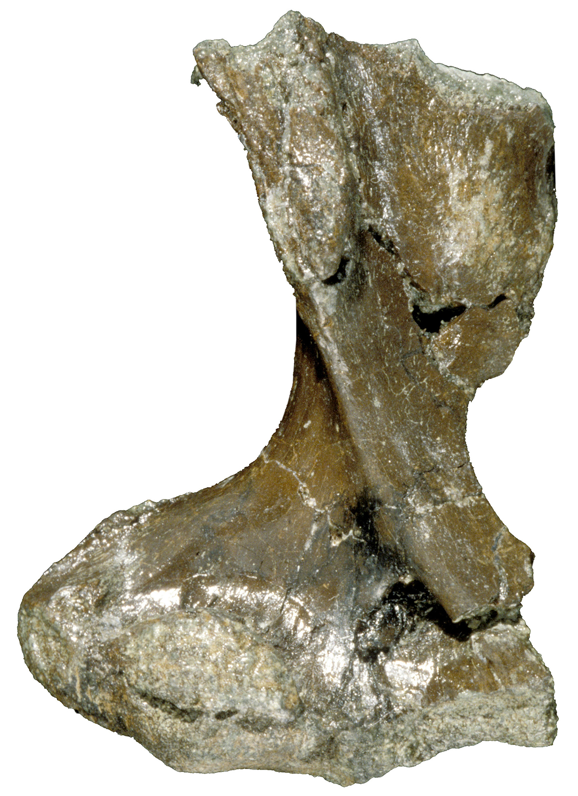 HUMERUS